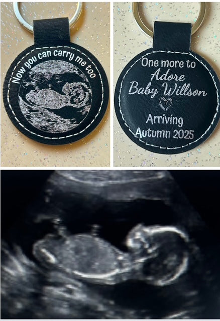 👶 Personalised Baby Ultrasound Keyring – Laser Engraved